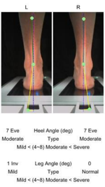 Ортопедический 3D сканер ScanPod3D USOL-X Floor