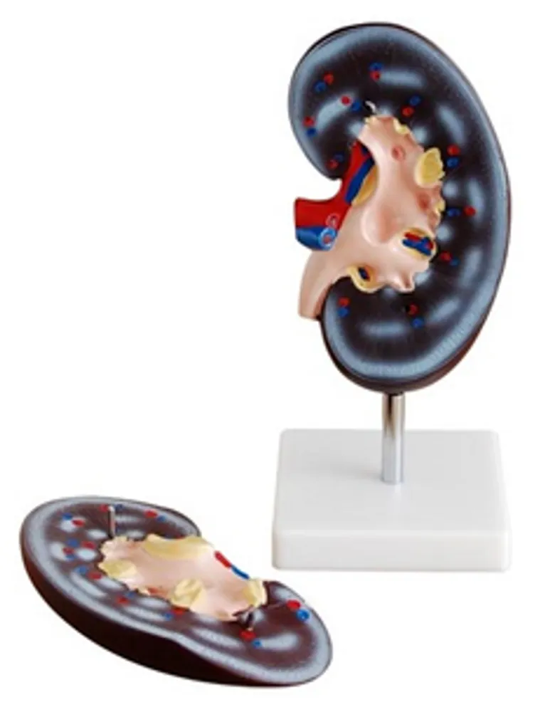 Модель объемная "Почка человека" ( разборная на 2 эл.)