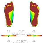 Ортопедический 3D сканер ScanPod3D USOL-X